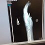 My Hand X-Rays