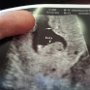 I'm Going To Be A Dad